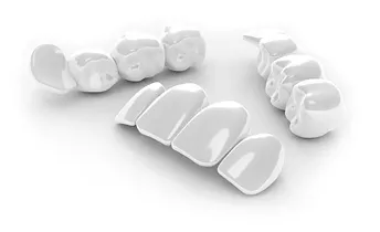 temporary restorations used to transition patients to 3-on-6 dental implants